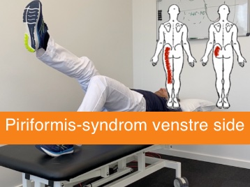 Genoptræningsprogram piriformis-syndrom i venstre side