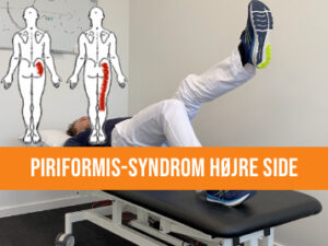 Øvelser til piriformis-syndrom - højre side